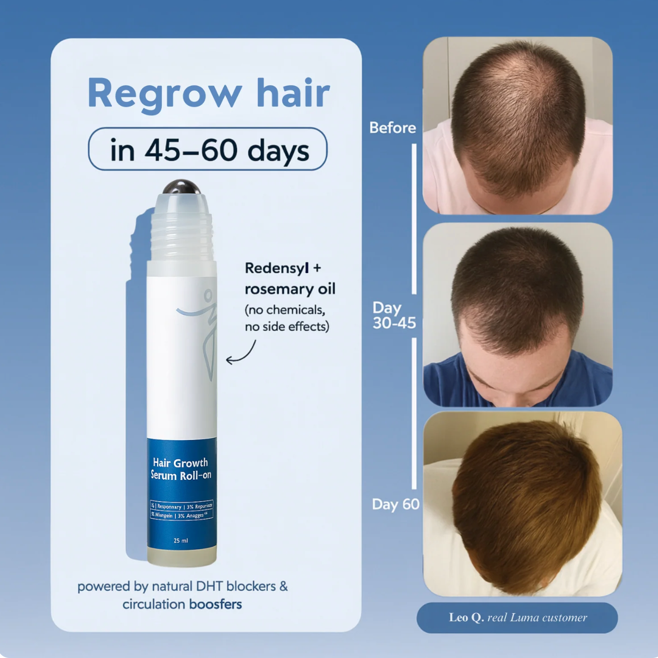 Hair Growth Roll-on